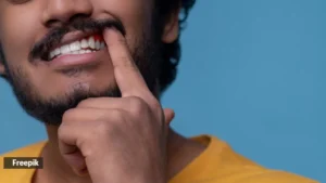 Beat the Summer Dry Spell: Expert Advice for a Moist and Healthy Mouth