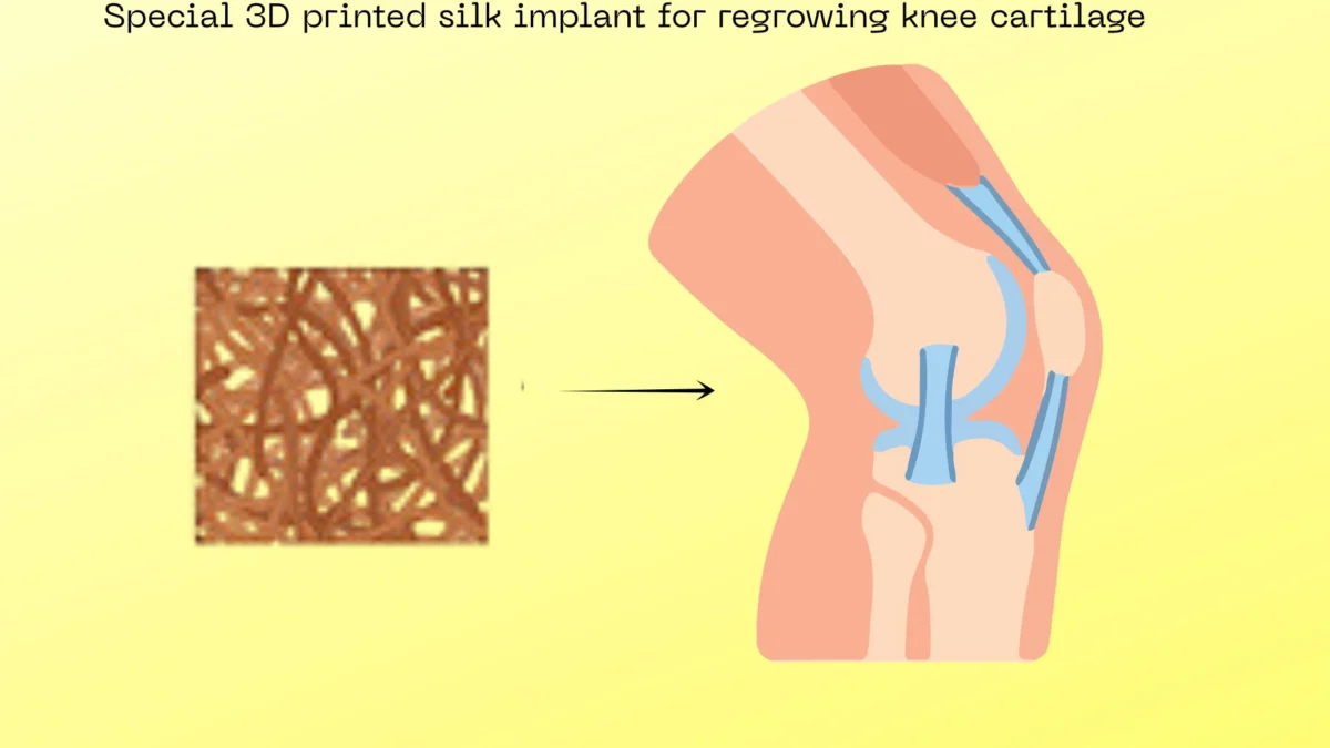 From Silkworms to Skeletal Repair: How 3D-Printed Silk Implants are Revolutionizing Osteoarthritis Treatment