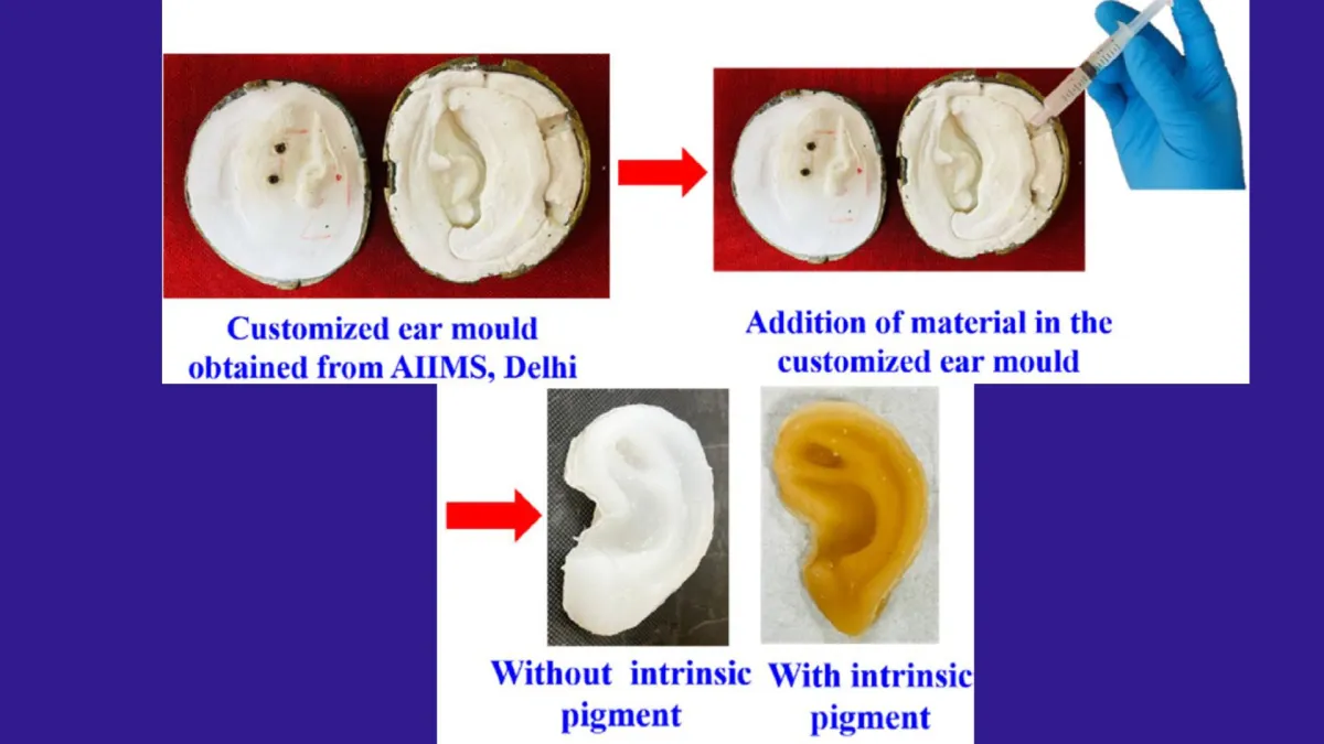 Engineering Resilience: How Indian Researchers are Redefining Medical Prosthetics for the Tropical Climate