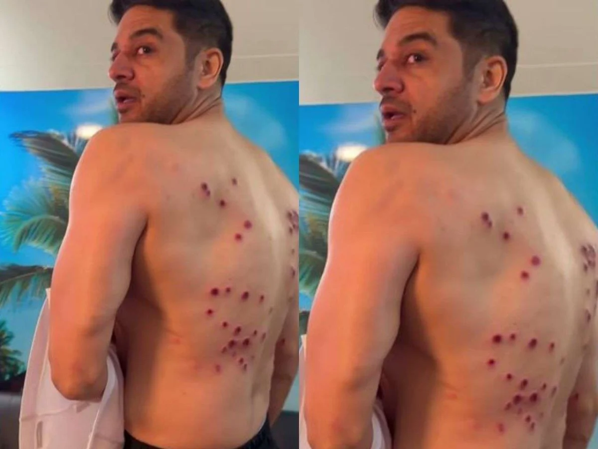 Gaurav Khanna Endures "Most Painful" Stunt on Khatron Ke Khiladi 15, Recalls Lingering Scars Amidst Personal Turmoil