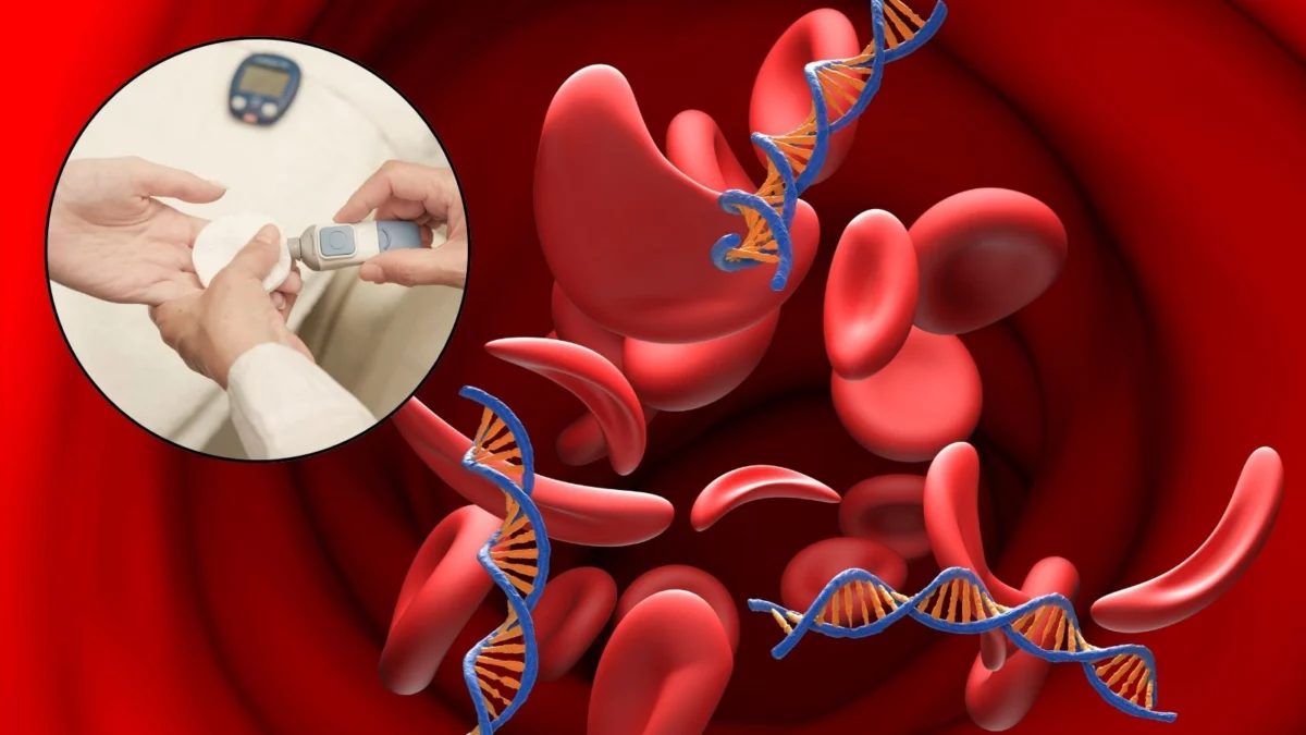 Unraveling the Glycemic Puzzle: How Anemia Can Skew Diabetes Test Results